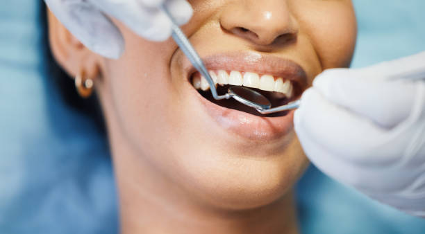 Trusted CA Emergency Dental Service Experts