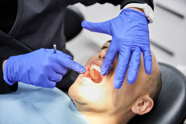 Best Emergency Care for Gum Disease in Yucos, CA